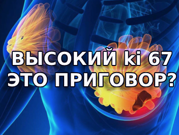 Высокий KI 67 это приговор?