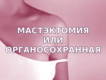 Сохраняющая операция при РМЖ или мастэктомия? Как принять решение?
