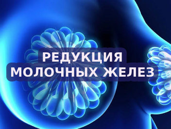 Редукция молочных желез