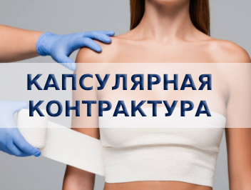 Капсулярная контрактура