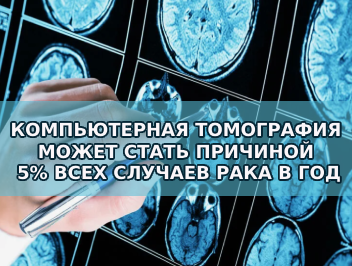 КОМПЬЮТЕРНАЯ ТОМОГРАФИЯ МОЖЕТ СТАТЬ ПРИЧИНОЙ 5% ВСЕХ СЛУЧАЕВ РАКА В ГОД
