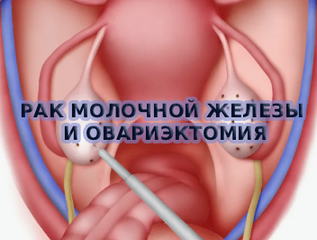 Рак молочной железы и овариэктомия