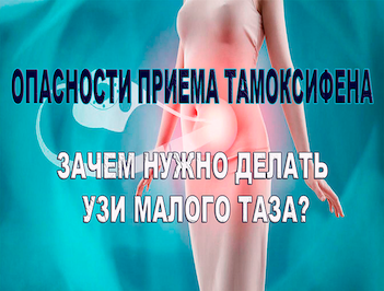 Как часто делать узи малого таза при приеме тамоксифена?